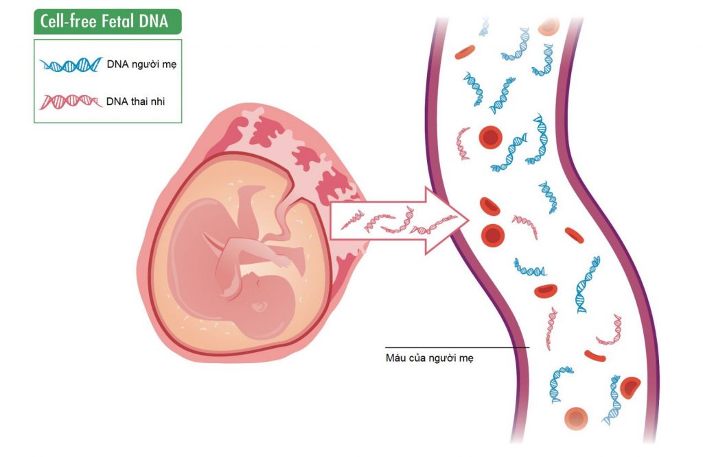 Cơ sở di truyền của xét nghiệm NIPT-TOTAL là phân tích cf-DNA của thai nhi trong máu mẹ, cực kì an toàn