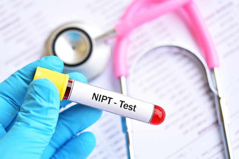 Sàng lọc trước sinh không xâm lấn NIPT