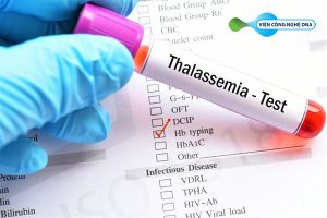 [Từ A-Z] Thalassemia – Những điều cần biết