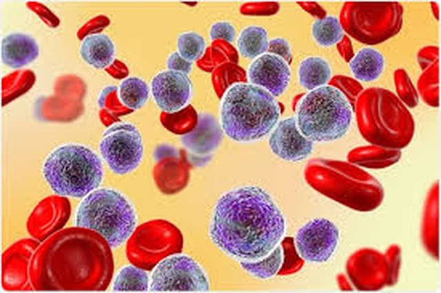 Các triệu chứng ung thư máu do số lượng tiểu cầu trong máu thấp