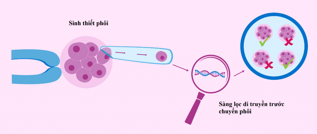 Xét nghiệm sàng lọc di truyền trước chuyển phôi (PGT)