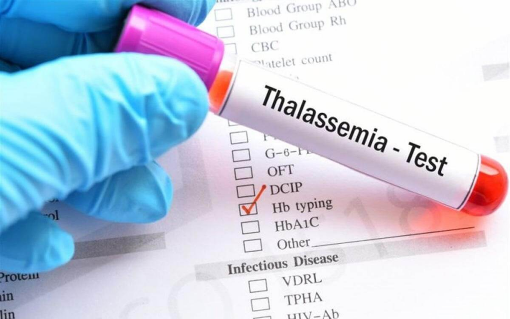 Thalassemia là một trong những bệnh di truyền nguy hiểm nhất