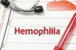 Làm gì để loại bỏ gen bệnh Hemophilia?