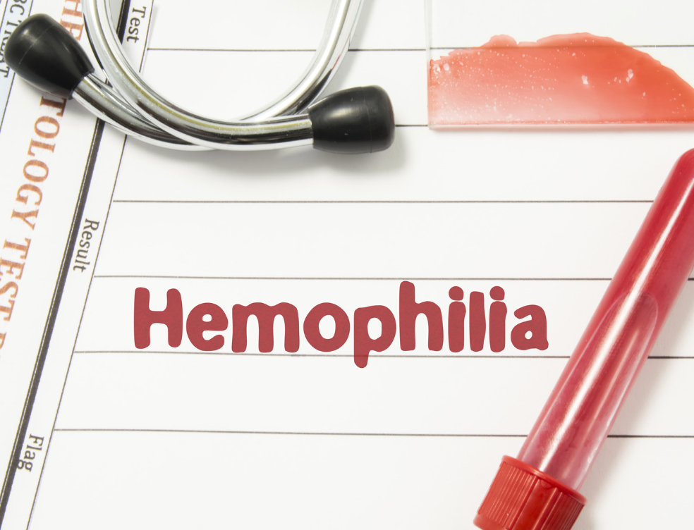 Hemophilia là bệnh máu khó đông, có tính di truyền