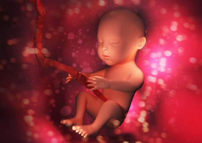 Có nhiều nguyên nhân ngay từ khi mang thai gây điếc bẩm sinh ở trẻ