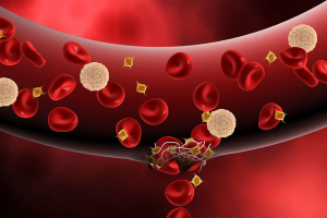 Các xét nghiệm di truyền liên quan đến căn bệnh máu khó đông Hemophilia A