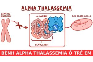 Bệnh Alpha Thalassemia: Nguyên nhân, triệu chứng, điều trị, và phòng ngừa