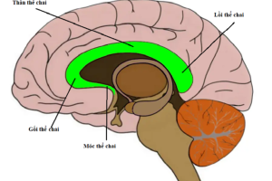 Bất sản thể chai (ACC): Nguyên nhân, Triệu chứng, và xử trí