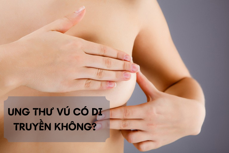 UNG THU VU CO DI TRUYEN KHONG