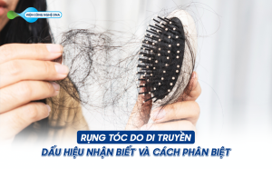 RỤNG TÓC DO DI TRUYỀN: DẤU HIỆU NHẬN BIẾT VÀ CÁCH PHÂN BIỆT